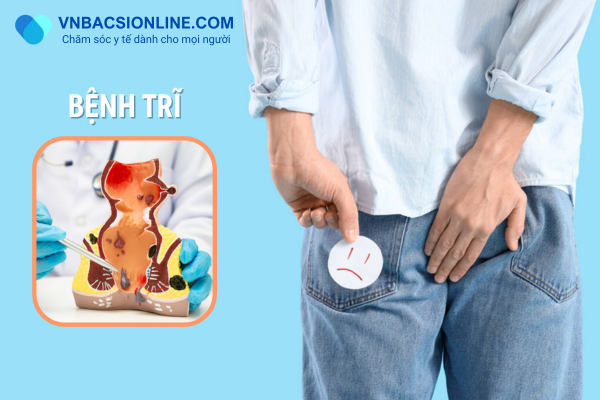 nguyen-nhan-gay-benh-tri%20(1).png